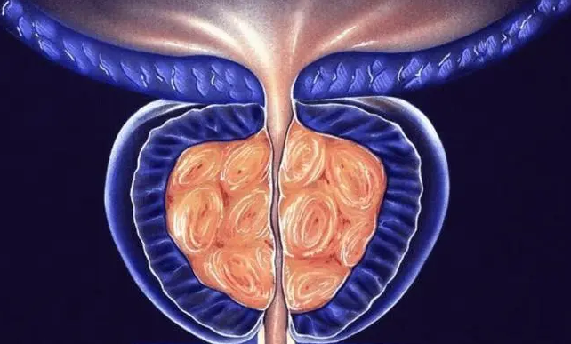高血压|养前列腺“高手”榜单已公布，比生蚝有用，你若爱吃，毒素冲走，清清爽爽
