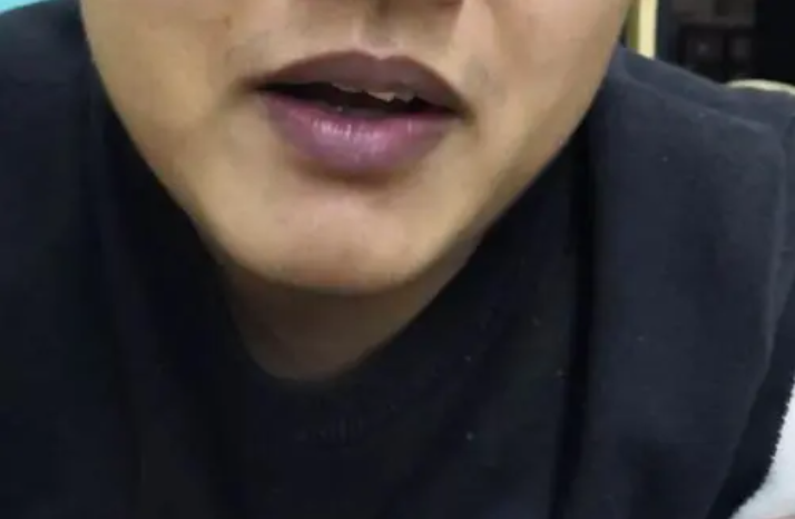 肺癌|肺癌并非悄无声息！医生坦言：头部若有4个表现，或是癌细胞“苏醒”，莫大意