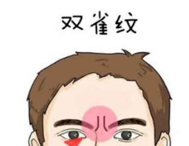 玄风命理|印堂上不同纹路，其寓意也不同！