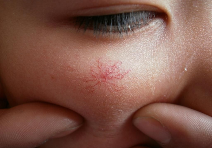 脂肪肝|新婚丈夫半年脂肪肝转癌,医生:2种食物不忌口,神仙也救不了你