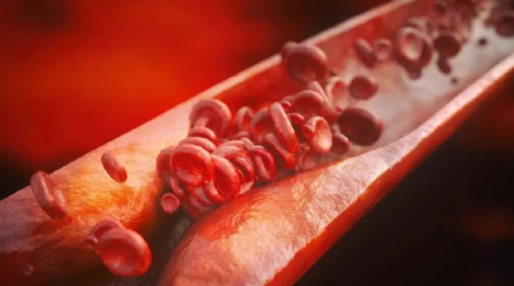 紫薯|这1物是天然“溶栓药”，平时吃一口，清血栓防脑梗