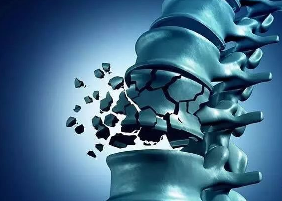 骨质疏松|“烂骨王”被找到！1种小菜正在悄悄挖空你的骨骼，转告家人，趁早忌口