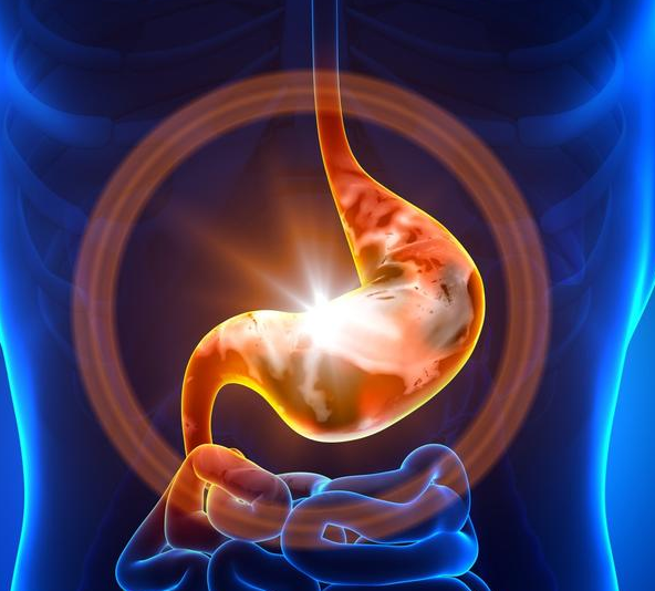 胃病|小米粥是胃病的“清洁剂”？建议：若想养胃，3种食物要少吃