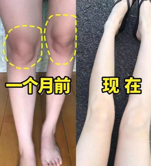 好物官|有一种“牛奶肌”叫林允，看到生图下的“筷子腿”，A爆全场