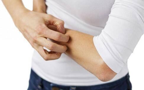 肝脏|24岁女子浑身瘙痒，3个月后确诊肝硬化，主任：身上2处发痒，趁早做肝CT