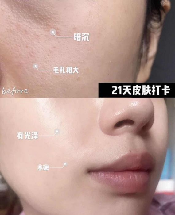 风起洛阳|是药三分毒！31岁沈梦辰为美全身擦粉，张嘉倪靠精华变“白天鹅”