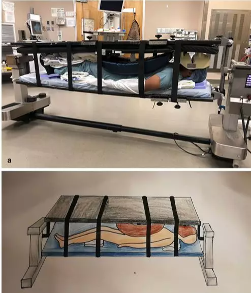 青菜|给大家介绍一种新的手术体位摆放方法