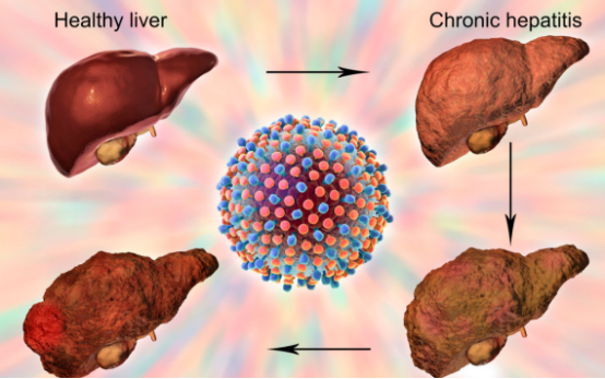 睡眠|面部出现3种异常，说明肝已“硬如磐石”，占一个，也要早做检查