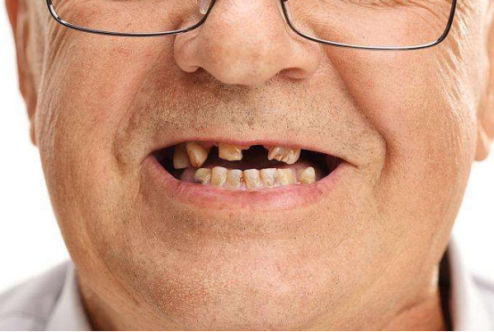 骨质疏松|老人补钙多吃它,堪称民间“补钙高手”,常吃慢慢养出“壮骨”