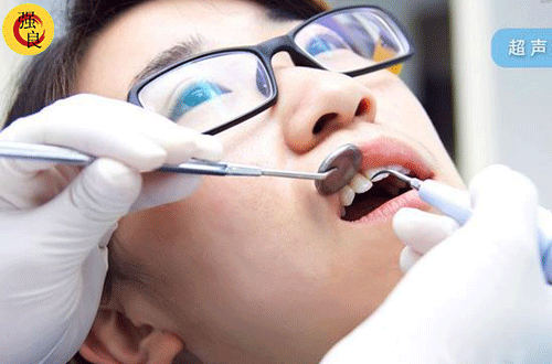强良之声 洗牙是救牙还是套路?爱牙的你快来看看吧。