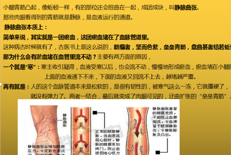 静脉曲张|看倪海厦老师，是如何用3味药，就搞定静脉曲张问题的？