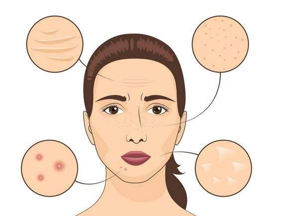 肝脏|脸上有4个信号，肝脏已经“弱”爆了，小心肝硬化找上门