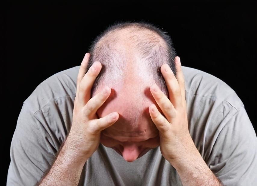 脱发|这几个防脱骚操作需谨慎，要当心加重脱发！