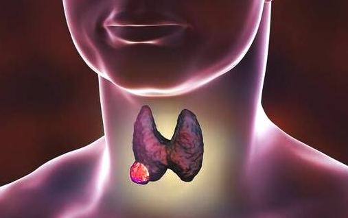 南瓜|常喝小米粥可以消散甲状腺结节？医生：若想呵护甲状腺，2“粗粮”要少吃