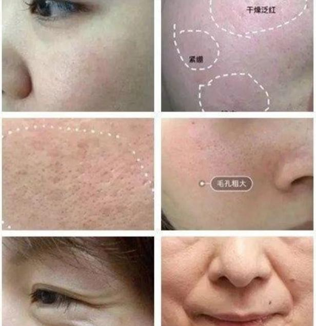 好物官|泰国连续打6年“美白针”的女子！如今怎么样了？网友：难以置信