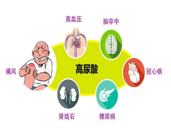 尿酸|男性尿酸高，如何让尿酸更好排出体外？总结了3个方法，实用有效