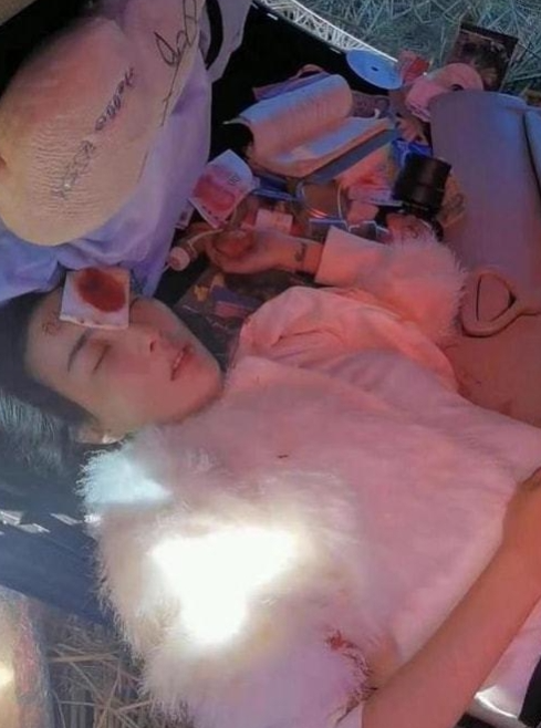 刘亦菲|李羲儿发生严重车祸缝了54针，一些网友的评价却不堪入目