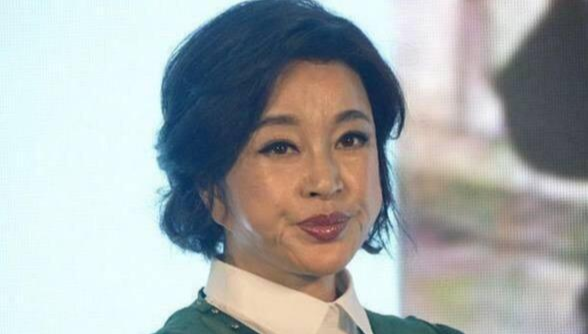 好物官|女星为什么不再用“玻尿酸”而选美容仪?内行人说出实情:脸太肿