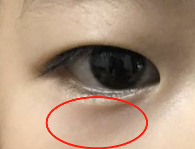 T恤衬衫白帆布 6岁女童停止发育,医生:2物吃一口,如吃橡皮泥,很多家长还不知