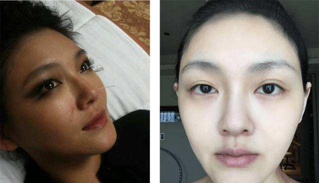 好物官|泰国打“美白针”的女人，整容9年只为“皮肤回春”，如今啥样了