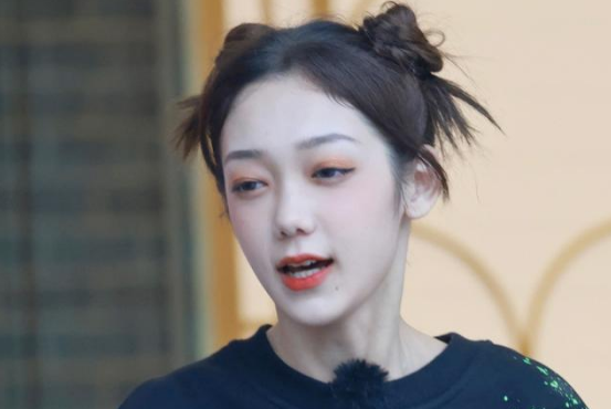 发际线|难怪希林娜依高总蓬蓬头，一扎马尾发际线亮了，偶像也躲不过变秃！