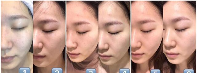 好物官|杭州女子为变美，自己注射“美白针”，结果“高烧不退”