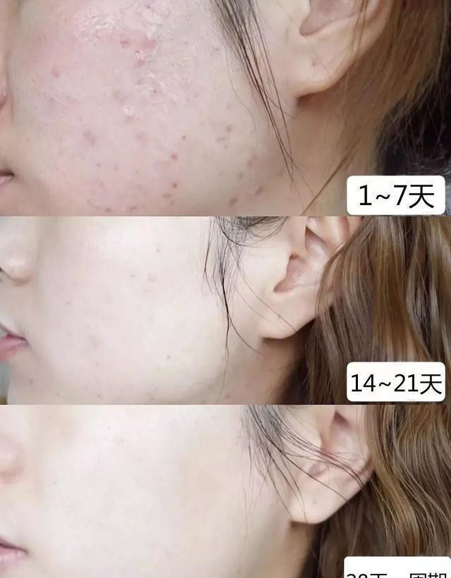 张雅钦|44岁陈数的皮肤“0”毛孔，颜值吊打36岁佟丽娅，护肤秘诀大公开