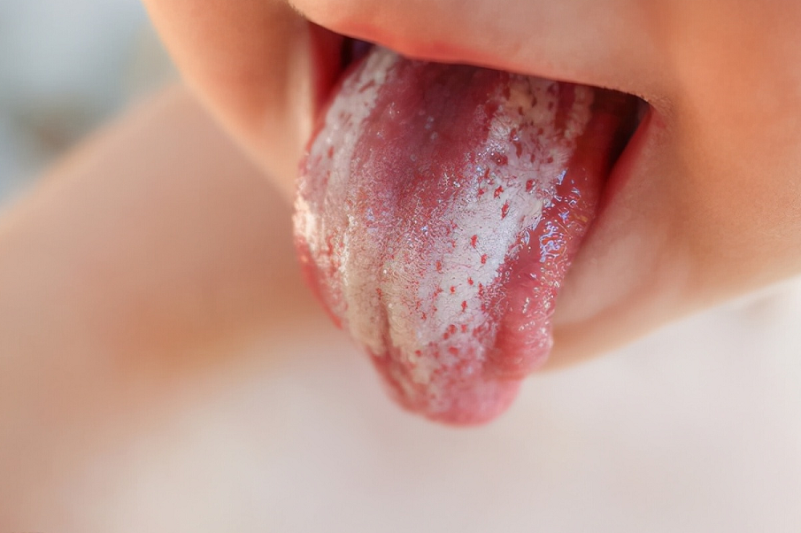 脾胃|4岁男童咳嗽半年，查出脾胃早衰，医生：超市“1奶”伤脾不浅，别给娃喝