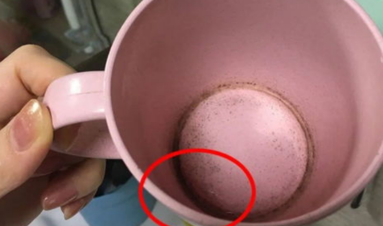 医生|25岁女子患甲状腺结节,医生叹息:天天洗脸,就不知道洗洗“它”