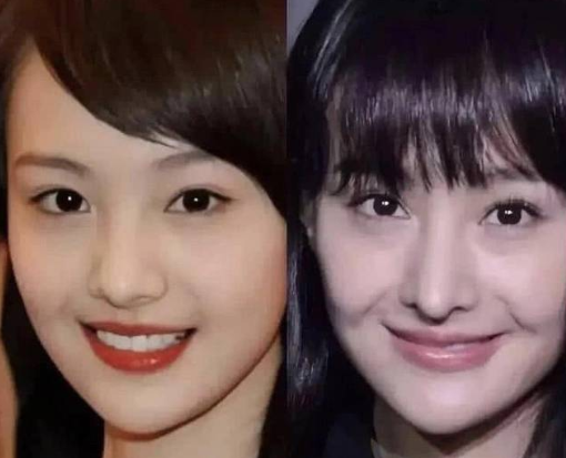 郑爽|郑爽整容变脸史:你相信“相由心生”么?