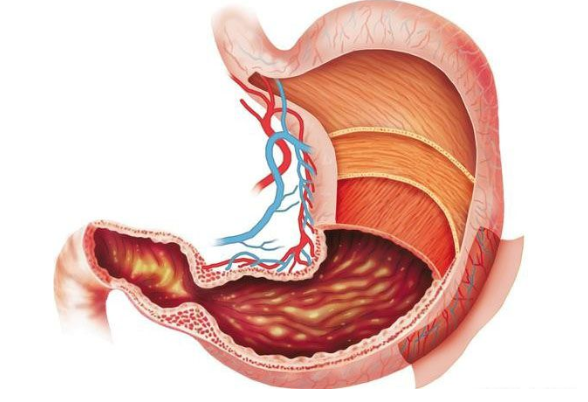 |10个做胃镜的人里面就有1个得此病,非常容易发展成胃癌