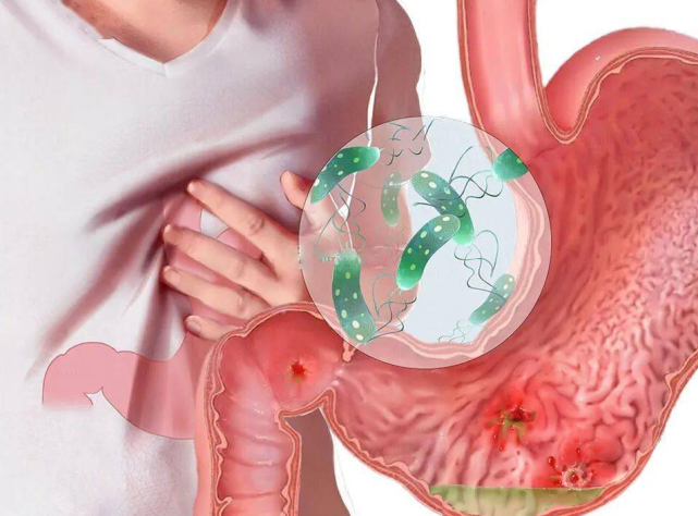 胃癌|夫妻二人双双患胃癌，医生痛惜：南瓜这样吃，或是在“培养”癌细胞