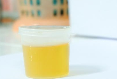 医线天|吃茄子有损肝脏？医生：无知！不想肝功“下降”，3种蔬菜最好别吃