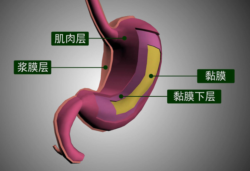 胃癌|胃癌“帮凶”已公布，幽门螺旋杆菌不是首因，医生：4种行为会加速癌变