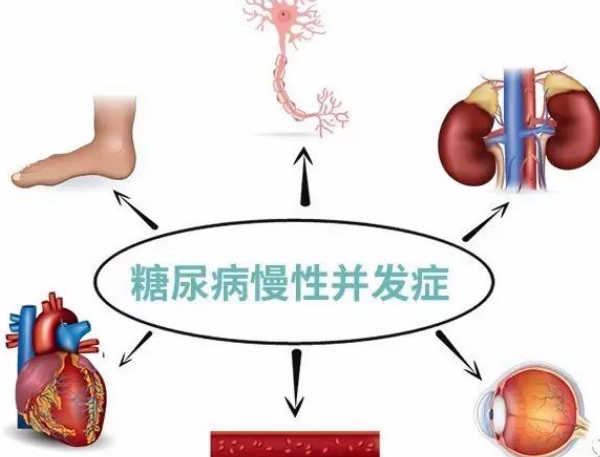 千金芳|42岁农民工以为皮肤过敏，确诊糖尿病，医生：身体1处发痒，趁早检查