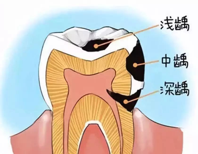 心脏|牙刷刷不到的地方，你再努力它也刷不到！！！