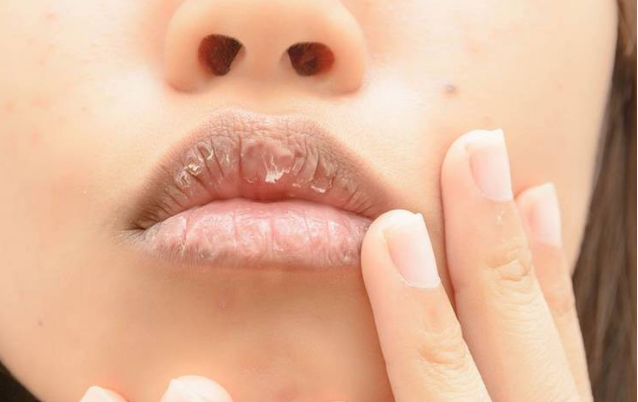 医生|肝癌多是“拖”出来的,身体3处“裂开”,没准肝已癌变,早查肝CT