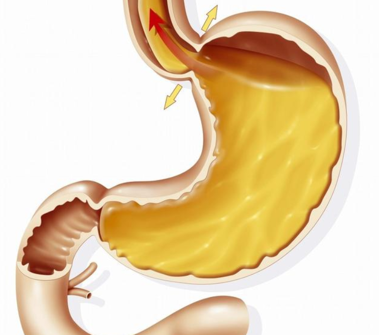 红薯|胃不好不能吃“红薯”？提示：养胃始于饮食，这3物，胃不好可常吃