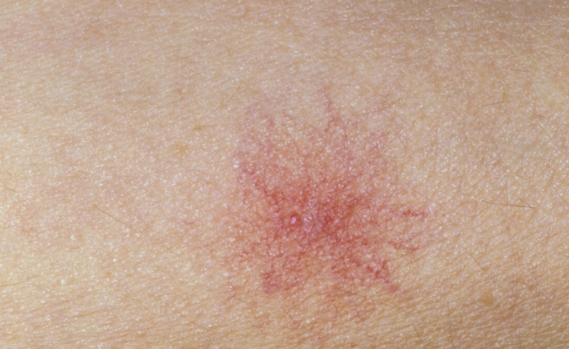 39健康网|32岁男子查出肝癌，化疗后数次离世，医生怒斥：冰箱1物怎可常吃