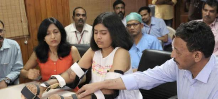 印度女孩因車禍失去雙臂，手術移植黑人手臂，2年後皮膚開始變黑-圖3
