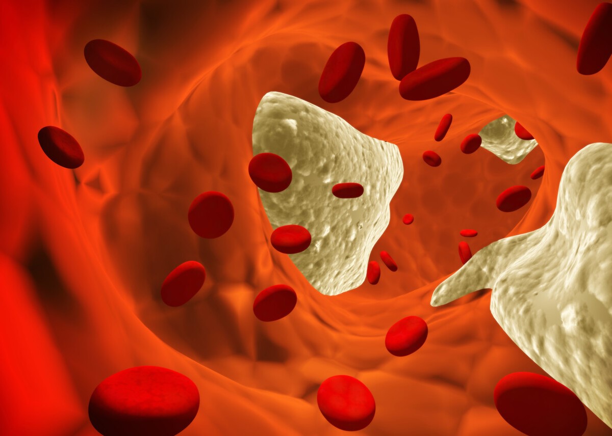 高血脂|“高血脂”禁食榜单公布：鸡蛋在内，榜首不少人当成补品