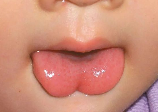 39健康网|吃一回胜过6斤苹果！儿科主任提醒：脾虚孩子若坚持吃，消积食、长得高