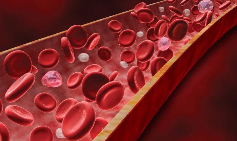 高血脂|高血脂“源头”是肥肉？医生：不想血管“堵死”，3种蔬菜要忌口