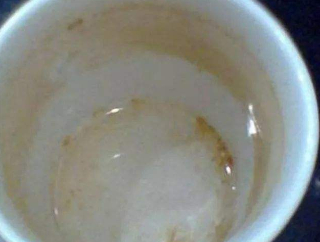 近视|?58岁阿姨坚持刷牙，确诊甲状腺癌，医生叹息：刷牙后这1习惯害人不浅