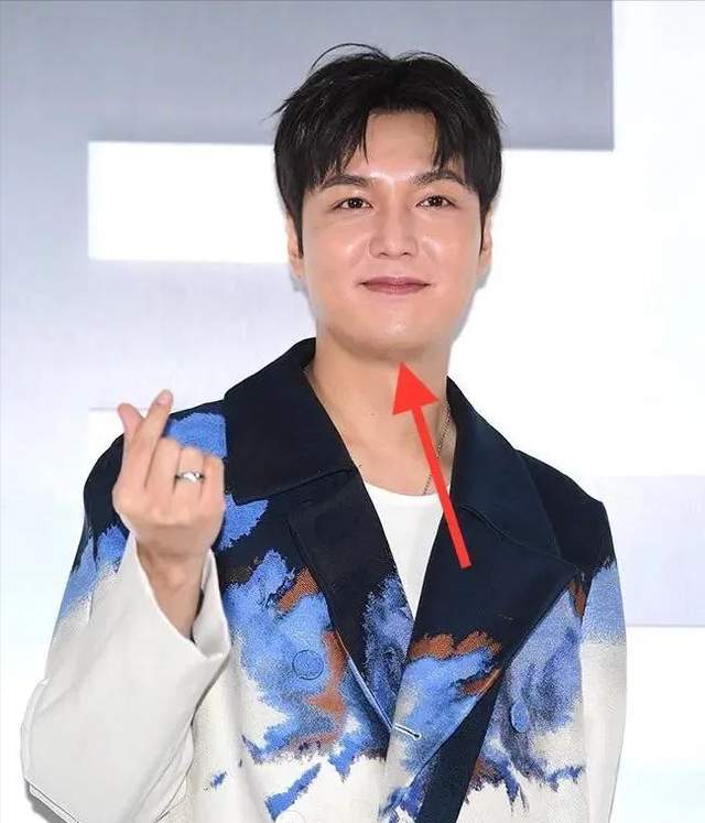 李敏镐发福严重,门牙起黑缝,又油又胖姨味重 - 娱乐资讯(主打网)