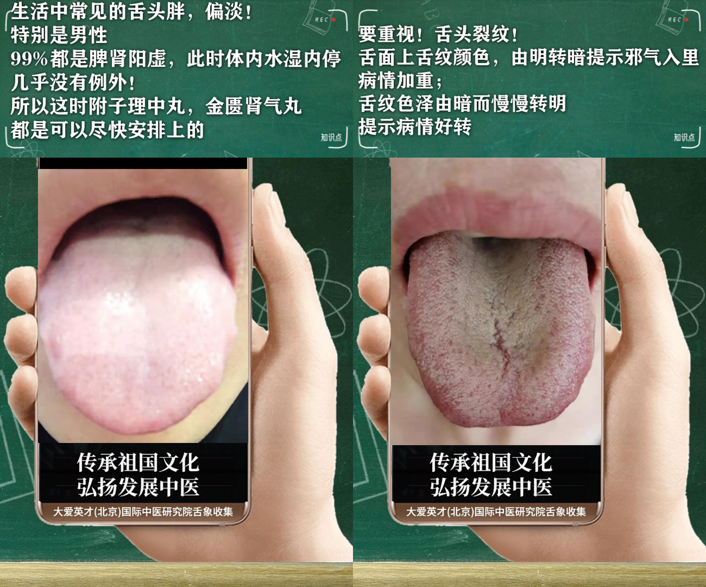 安神|中医病症：懦弱、手足心热、痰多色白、一直未愈很难受