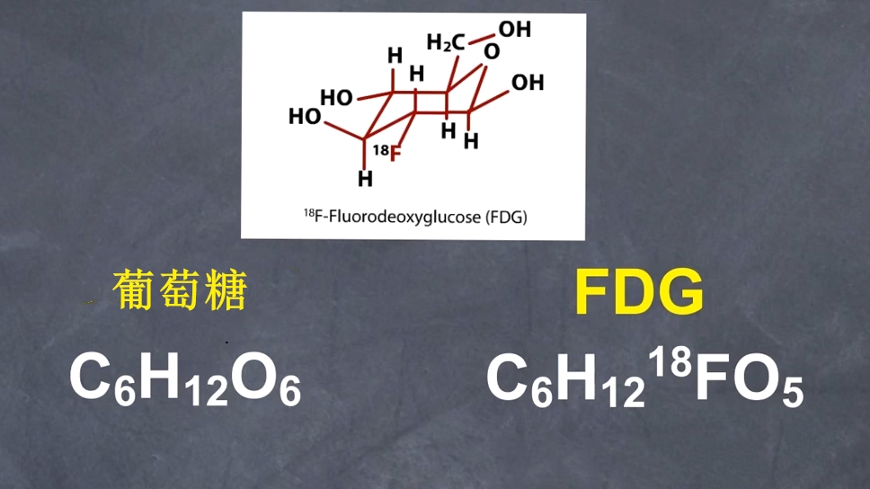 反物质的应用:正电子发射断层扫描