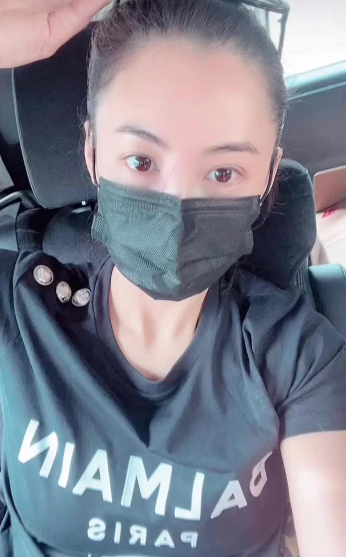 秦岚|张柏芝透露被3岁小儿子抓伤脸，伤口很长遮不住，自称“刀疤张”