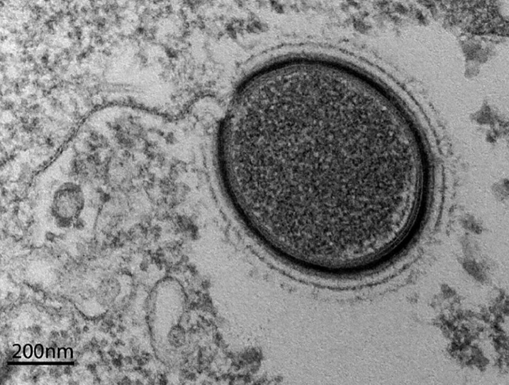 西藏冰川正在融化，近1000种远古微生物，或将解除“封印”！