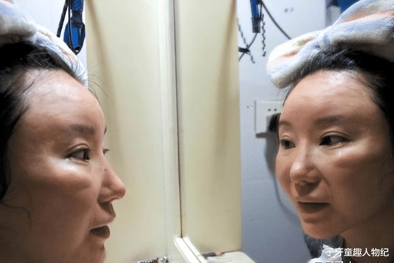 整容|红粉宝宝：16岁开始整容，花400万整容200多次，最后沦落到坐轮椅